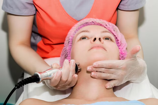laser treatment for acne scars