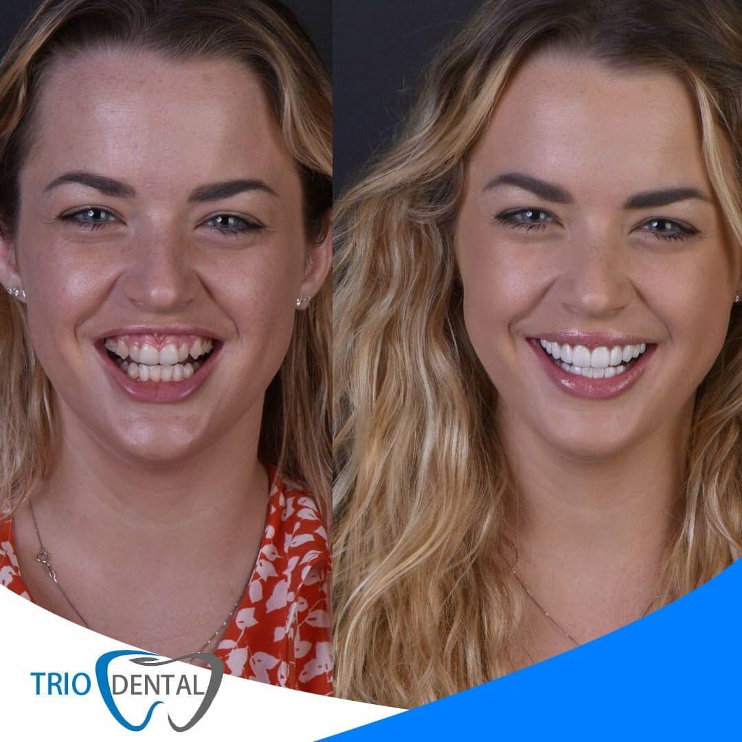 best dental services